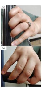 Dedos 3 y 4 en el violonchelo: cómo evitar el colapso
